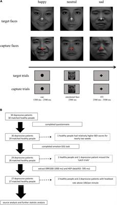 Interoception Dysfunction Contributes to the Negative Emotional Bias in Major Depressive Disorder